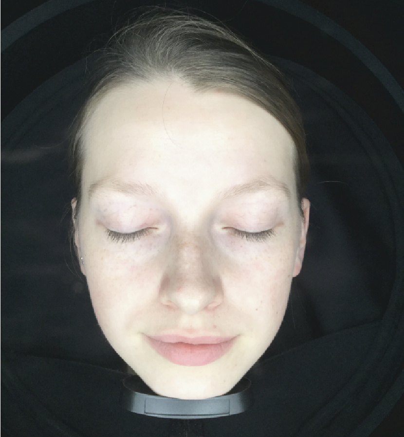 metis analizador facial diagnostico
