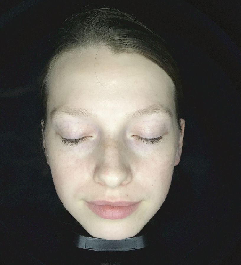 metis analizador facial diagnostico
