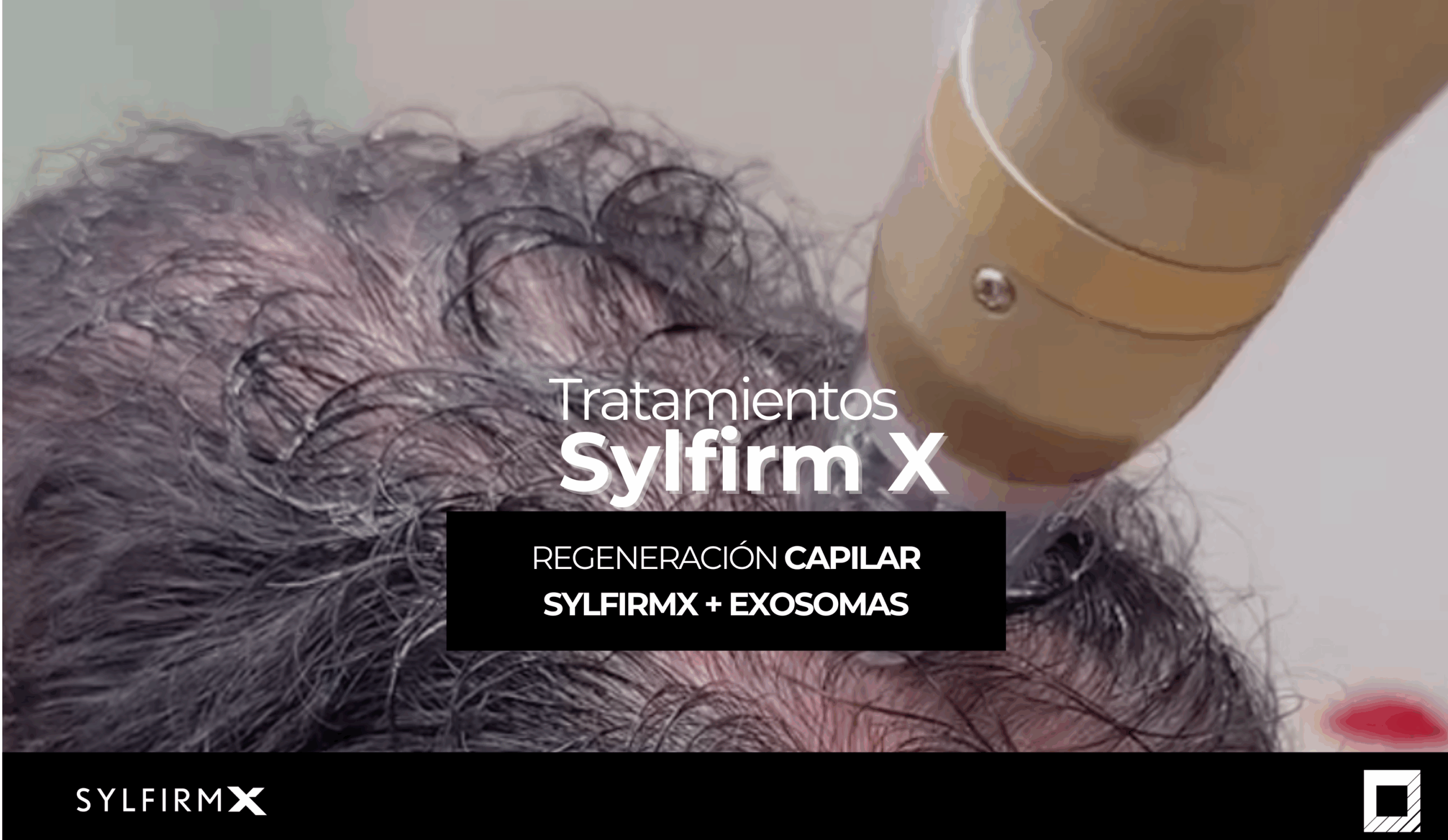Sylfirm X – Tecnología para Regeneración Capilar