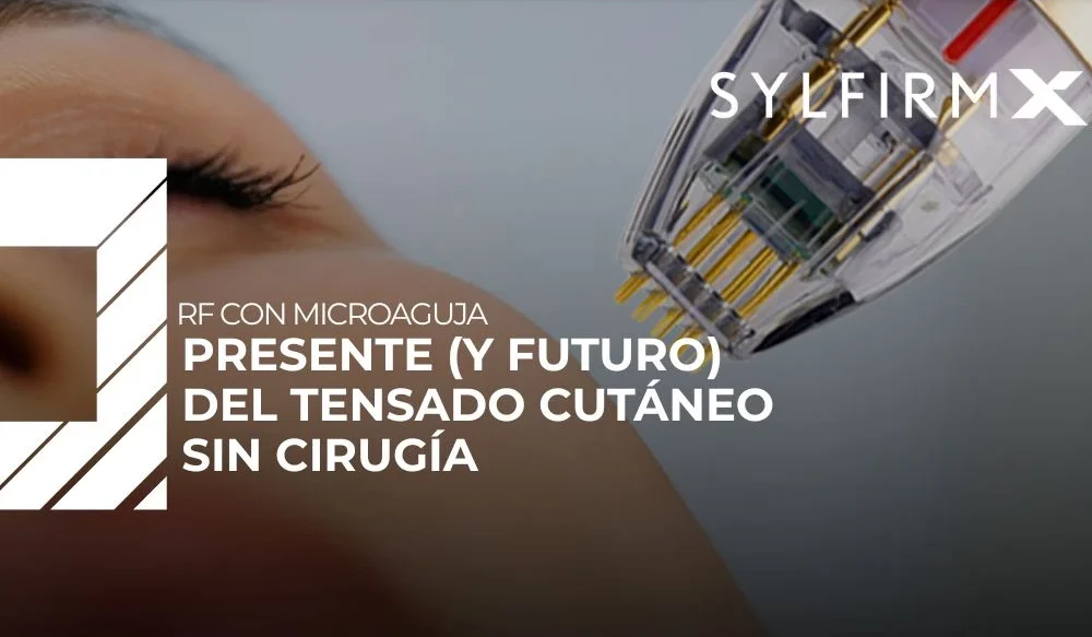 RF con microaguja: presente (y futuro) del tensado cutáneo sin cirugía