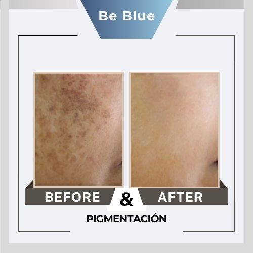 Be blue Before&After