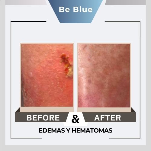 Be blue Before&After