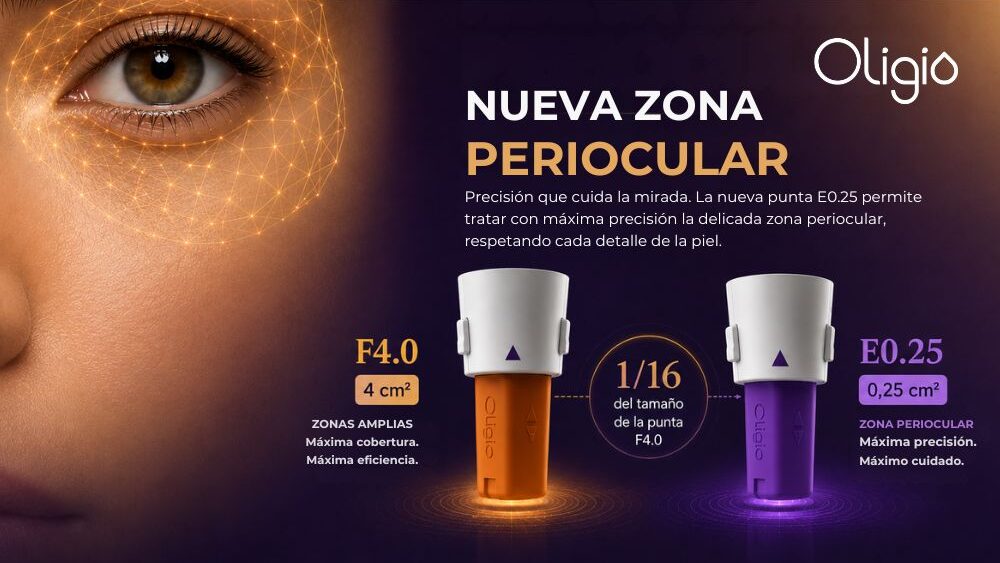 RF monopolar en la zona periocular: punta E0.25 de Oligio®