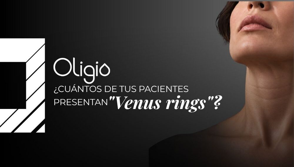 Venus rings y flacidez del cuello: abordaje con Oligio